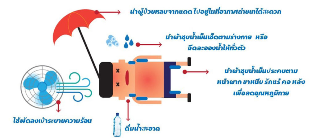 วิธีปฐมพยาบาลโรคลมร้อนเบื้องต้น