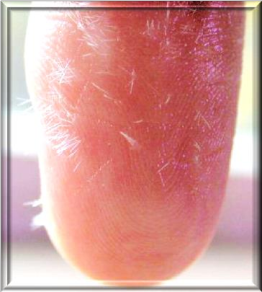 สัตว์ทะเลมีพิษและวิธีการปฐมพยาบาล