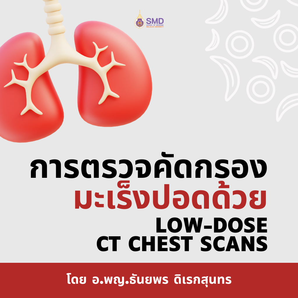 คัดกรองมะเร็งปอดด้วย Low-Dose CT: เรื่องที่คนกลุ่มเสี่ยงควรรู้